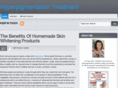 hyperpigmentationtreatment4u.com