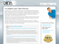 losangeleslasertattooremoval.com