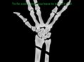 brokenlogic.net