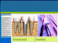 advancedentalimplants.com