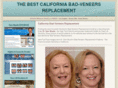 californiabadporcelainveneers.com