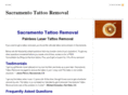 sacramentotattooremoval.net