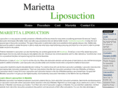 mariettaliposuction.com