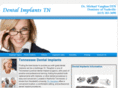 dentalimplantstn.com