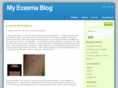 myeczemablog.com