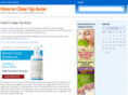howtoclearupacne.org