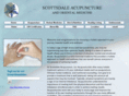 scottsdaleacupuncture.com