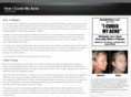 cureacneholistically.net