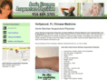 acupuncturedaviefl.com