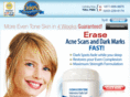 acnescareraser.com