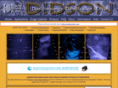 didson.com
