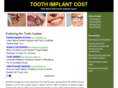 toothimplantcost.info