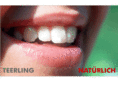 teerling.com