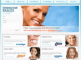 birminghambraces.co.uk