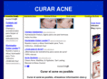 curaracne.com