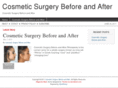 cosmeticsurgerybeforeandafter.net