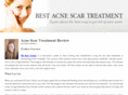 bestacnescartreatment.net