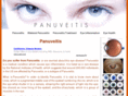 panuveitis.com