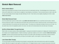 stretchmarkremovals.org