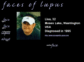 facesoflupus.com