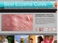 besteczemacures.org