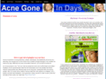 acnegoneindays.com