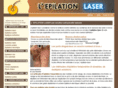 lepilation-laser.fr