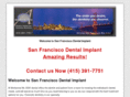 sanfranciscodentalimplant.net