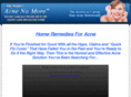 homeremediesforacne.me