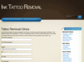 inktattooremoval.com