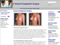 breastenlargementsurgery.net