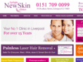 epilightnewskin.co.uk