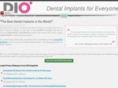 dioimplant.co.uk