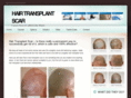 hairtransplantscar.com