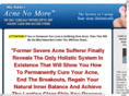 acnehomecure.info