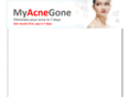 myacnegone.com