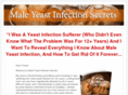 maleyeastinfectionsecrets.com