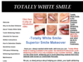 totallywhitesmile.com