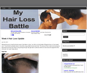 myhairlossbattle.com: Hair Loss Blog - My Battle Against Hair Loss
Hair loss blog detailing my regime as I hope to prevent hair loss and stop my receding hair line.