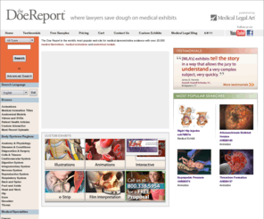 mdevidence.com: Medical Illustrations, Medical Animations
The Doe Report is the Internet's largest library of medical demonstrative evidence for attorneys, containing thousands of medical exhibits, medical illustrations, medical animations, anatomical models, and medical research.