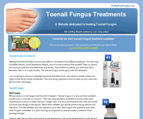 toenailfootfungus.com: Toenail Fungus Treatment.  The #1 cure available.
Reviews of the best products, so you can cure your nail fungus with easy treatments.