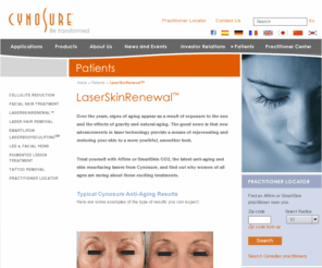 smartskin.com: Anti Aging Systems, Cosmetic Laser Services, Laser Skin Treatment - Patients - Cynosure

	Cynosure's Anti Aging Systems helps to effectively treat wrinkles, photo aging and skin discolorations caused by sun exposure and time.		