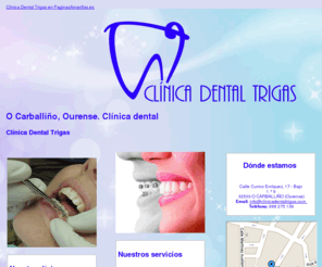 clinicadentaltrigas.com: Clínica dental. O Carballiño, Ourense. Clínica Dental Trigas
Clínica dental, expertos en salud buco dental. Dentistas profesionales, técnicas odontológicas. Tlf.: 988 275 139.