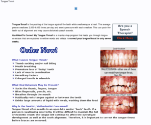 spotontheroof.com: Tongue Thrust Exercises
IJustWantTo Correct My Tongue Thrust - 7 Week Program, Start Today!