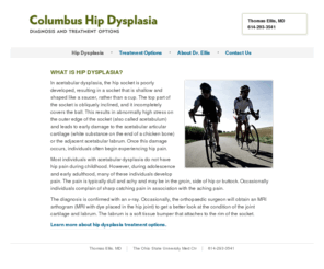 columbushipdysplasia.com: Columbus Hip Dysplasia - Dr. Thomas Ellis
Thomas Ellis, Acetabular Dysplasia specialist - Hip Dysplasia diagnosis and treatment.