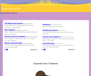 exposedacnetreatment.com: Exposed Acne Treatment
Exposed Acne Treatment.