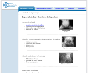 clinicadecadera.com: Servicios ortopedicos en Queretaro Mexico
Clinica especializada en cadera: luxacion congenita de cadera, fracturas de cadera, enfermedades degenerativas...