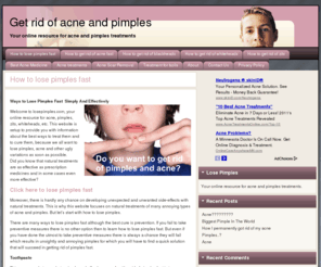 losepimples.com: How to get rid of pimples and acne
How to get rid of pimples and acne.