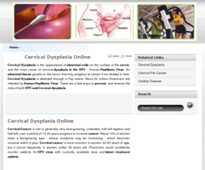 cervicaldysplasia.org: Cervical Dysplasia Online
Cervical Dysplasia is a condition in which cells in the cervix have undergone abnormal changes, treatment can prevent it from progressing to cervical cancer. Find more cervical dysplasia, HPV and cervical cancer information on cervicaldysplasia.org