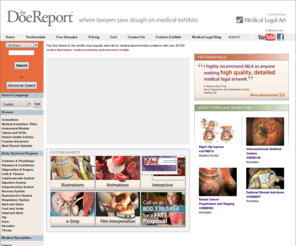 doereport.com: Medical Illustrations, Medical Animations
The Doe Report is the Internet's largest library of medical demonstrative evidence for attorneys, containing thousands of medical exhibits, medical illustrations, medical animations, anatomical models, and medical research.